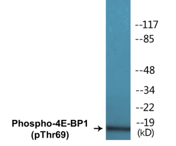 4E-BP1 (phospho Thr69) Cell Based ELISA Kit (A102787-296)