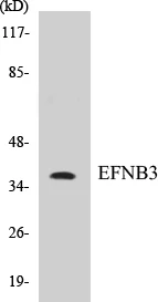 EFNB3 Cell Based ELISA Kit (A103058-96)