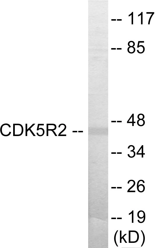 CDK5R2 Cell Based ELISA Kit (A103657-96)