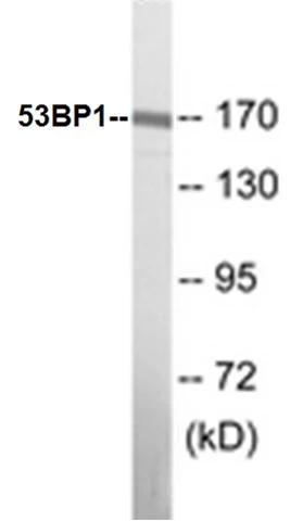 53BP1 Cell Based ELISA Kit (A103051-96)