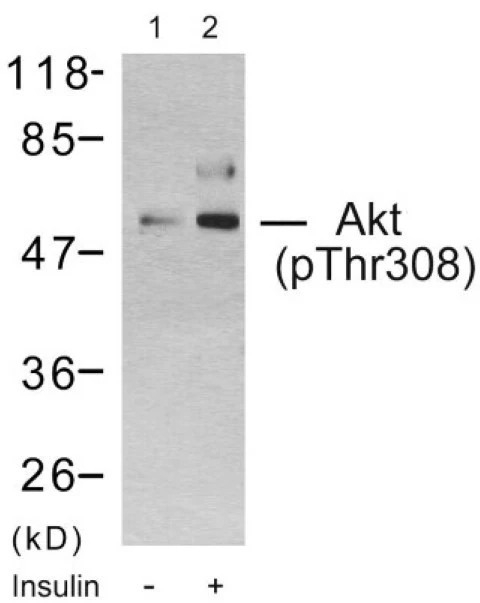 Akt (phospho Thr308) Cell Based ELISA Kit (A103822-296)