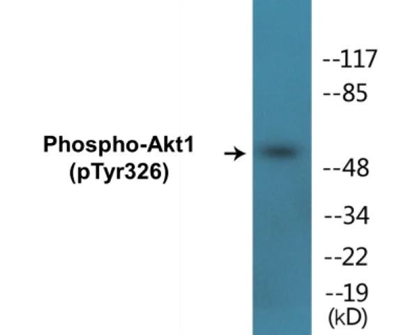 Akt1 (phospho Tyr326) Cell Based ELISA Kit (A102310-296)