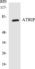 ATRIP Cell Based ELISA Kit (A103055-96)