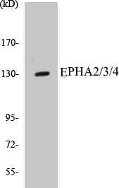 EPHA2 + 3 + 4 Cell Based ELISA Kit (A103579-96)