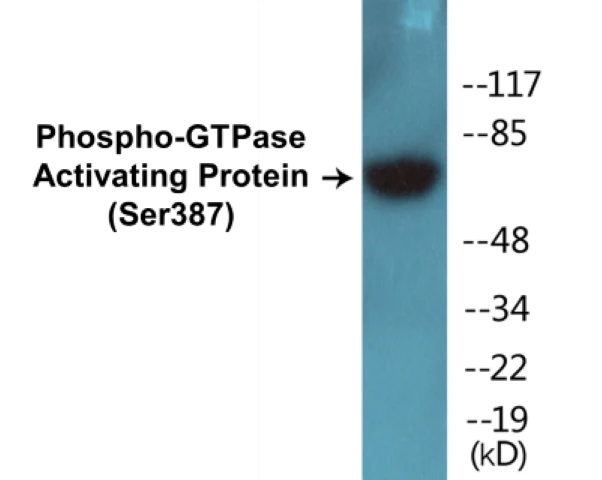 GTPase Activating Protein (phospho Ser387) Cell Based ELISA Kit (A102039-296)