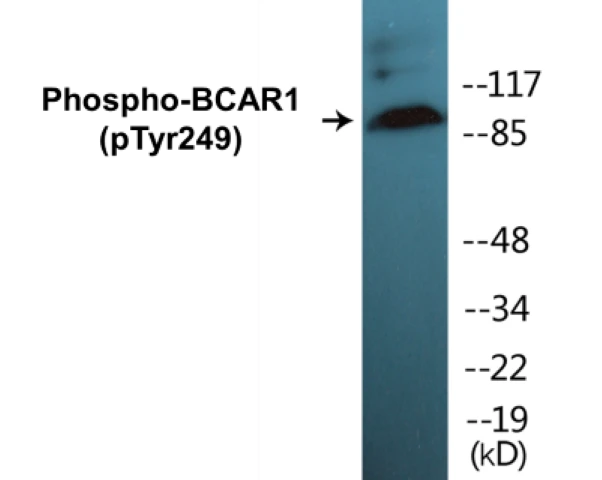 BCAR1 (phospho Tyr249) Cell Based ELISA Kit (A102174-296)