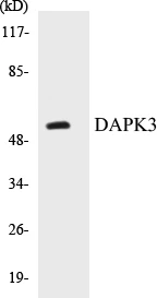 DAPK3 Cell Based ELISA Kit (A103086-96)