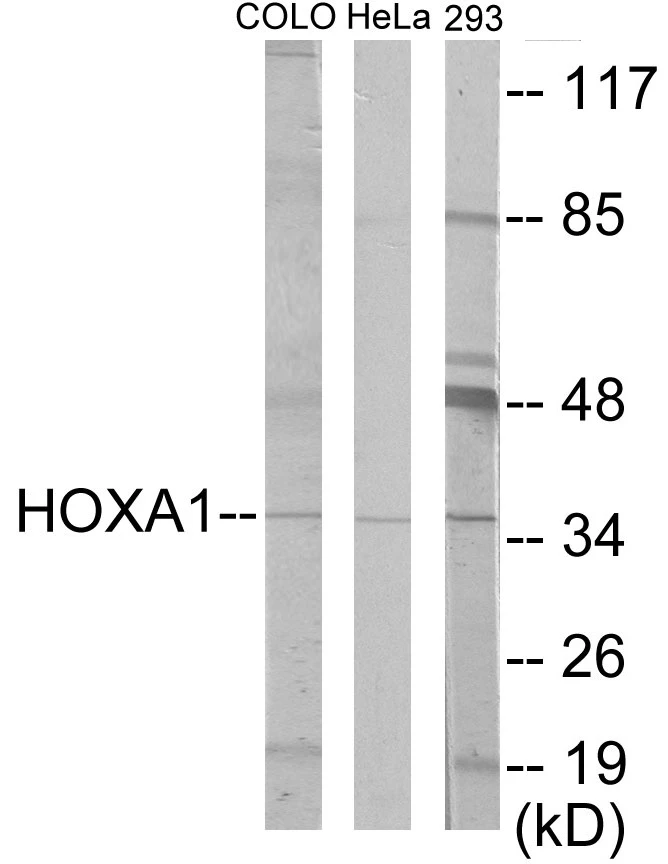 HOXA1 Cell Based ELISA Kit (A103147-96)