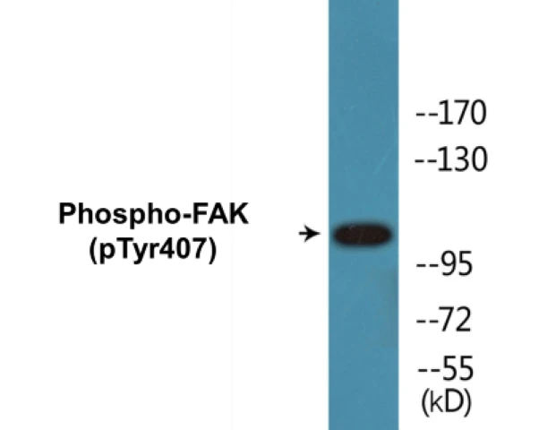 FAK (phospho Tyr407) Cell Based ELISA Kit (A102397-296)