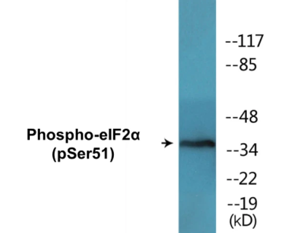 eIF2&#0945; (phospho Ser51) Cell Based ELISA Kit (A102247-296)