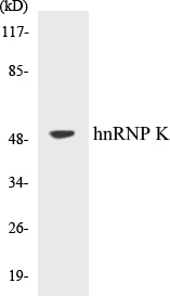 hnRNPK Cell Based ELISA Kit (A102998-96)