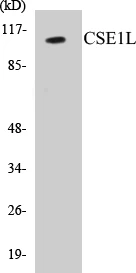 CSE1L Cell Based ELISA Kit (A103676-96)