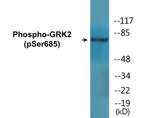 GRK2 (phospho Ser685) Cell Based ELISA Kit (A102262-296)