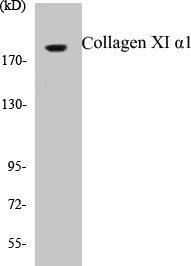 Collagen XI alpha 1 Cell Based ELISA Kit (A103353-96)