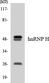 hnRNPH Cell Based ELISA Kit (A103024-96)