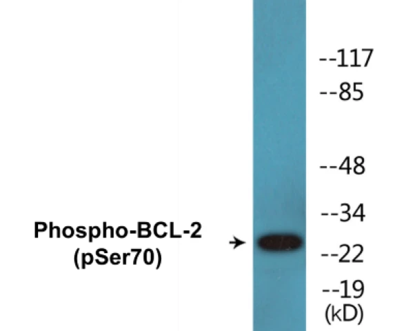 BCL-2 (phospho Ser70) Cell Based ELISA Kit (A102739-296)