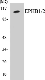 EPHB1 + 2 Cell Based ELISA Kit (A102935-96)