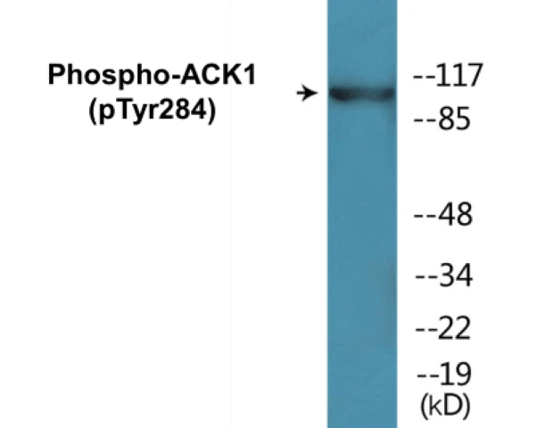 ACK1 (phospho Tyr284) Cell Based ELISA Kit (A102646-296)