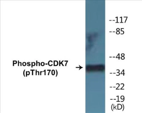 CDK7 (phospho Thr170) Cell Based ELISA Kit (A102651-296)