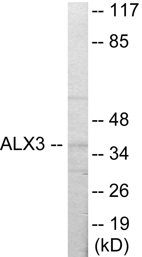 ALX3 Cell Based ELISA Kit (A103269-96)