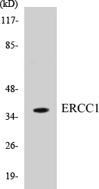 ERCC1 Cell Based ELISA Kit (A103438-96)