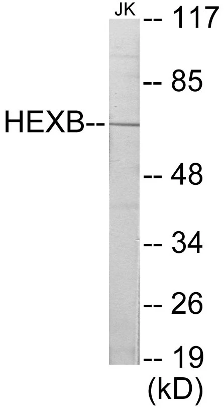 HEXB Cell Based ELISA Kit (A103712-96)