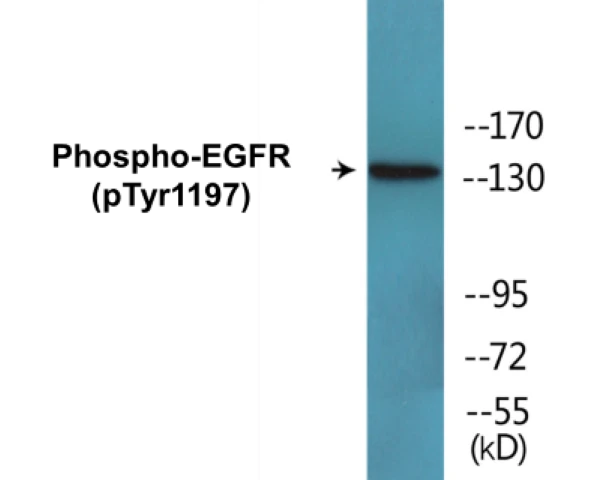 EGFR (phospho Tyr1197) Cell Based ELISA Kit (A102159-296)