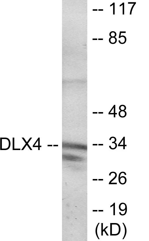 DLX4 Cell Based ELISA Kit (A103742-96)