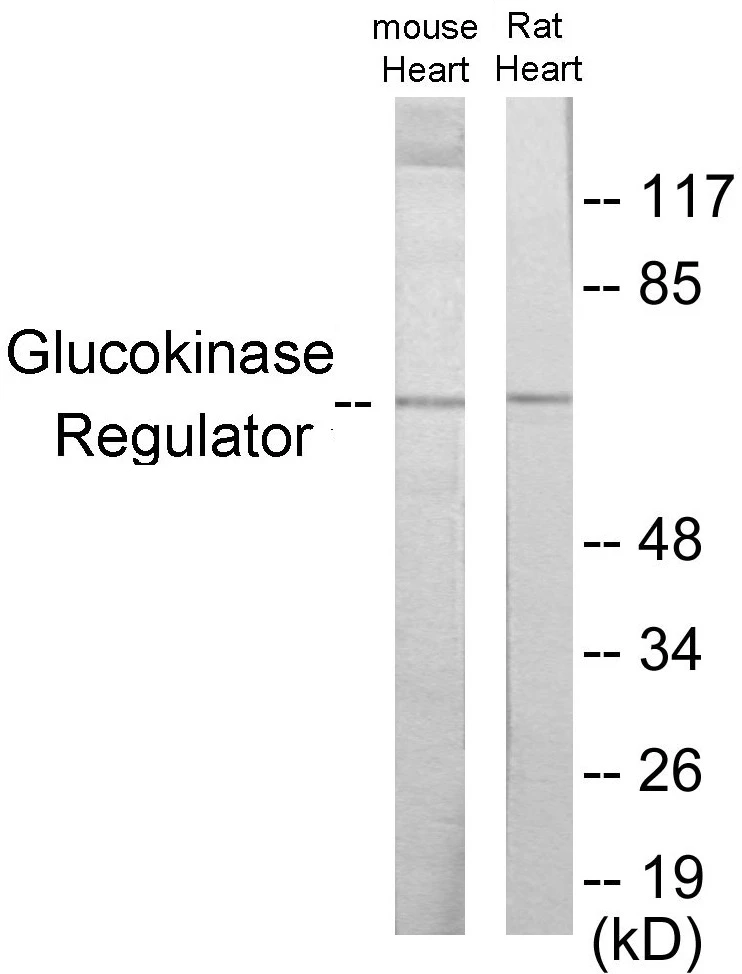 Glucokinase Regulator Cell Based ELISA Kit (A102803-96)