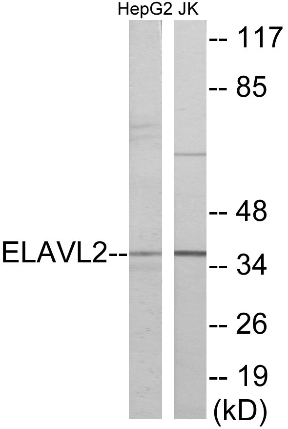 ELAVL2 Cell Based ELISA Kit (A103026-96)