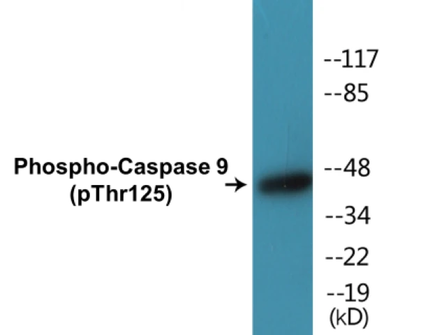 Caspase 9 (phospho Thr125) Cell Based ELISA Kit (A102536-296)