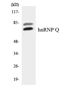 hnRNPQ Cell Based ELISA Kit (A103018-96)