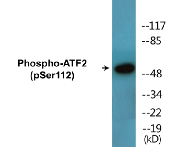 ATF2 (phospho Ser112) Cell Based ELISA Kit (A102324-296)