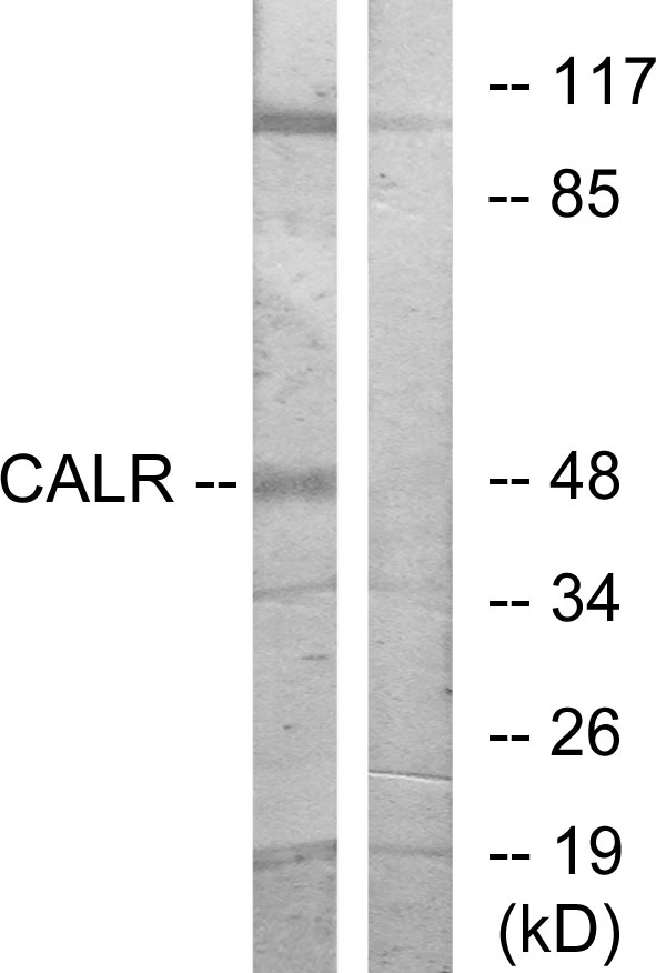 CALR Cell Based ELISA Kit (A103179-96)