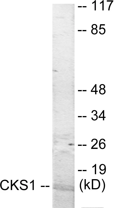 CKS1 Cell Based ELISA Kit (A103545-96)