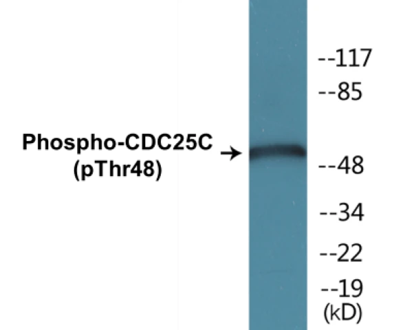 CDC25C (phospho Thr48) Cell Based ELISA Kit (A103785-296)