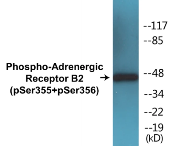 Adrenergic Receptor B2 (phospho Ser355 + Ser356) Cell Based ELISA Kit (A102038-296)