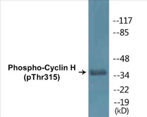 Cyclin H (phospho Thr315) Cell Based ELISA Kit (A102583-296)