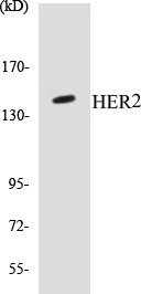 HER2 Cell Based ELISA Kit (A103181-96)