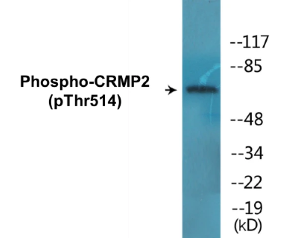 CRMP2 (phospho Thr514) Cell Based ELISA Kit (A102157-296)