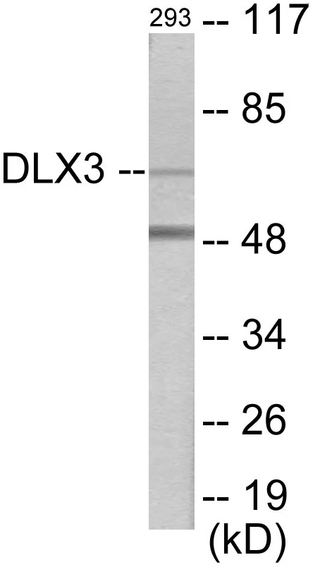 DLX3 Cell Based ELISA Kit (A103538-96)