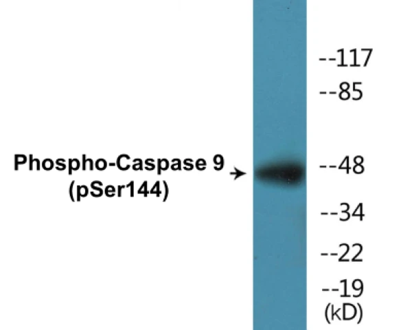 Caspase 9 (phospho Ser144) Cell Based ELISA Kit (A102775-296)