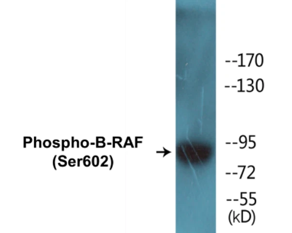 B-RAF (phospho Ser602) Cell Based ELISA Kit (A102143-296)