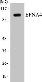 EFNA4 Cell Based ELISA Kit (A103435-96)