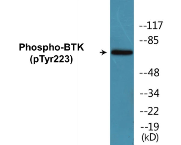 BTK (phospho Tyr223) Cell Based ELISA Kit (A103824-296)