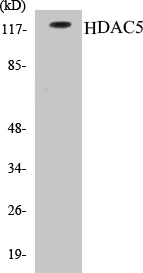 HDAC5 Cell Based ELISA Kit (A103426-96)