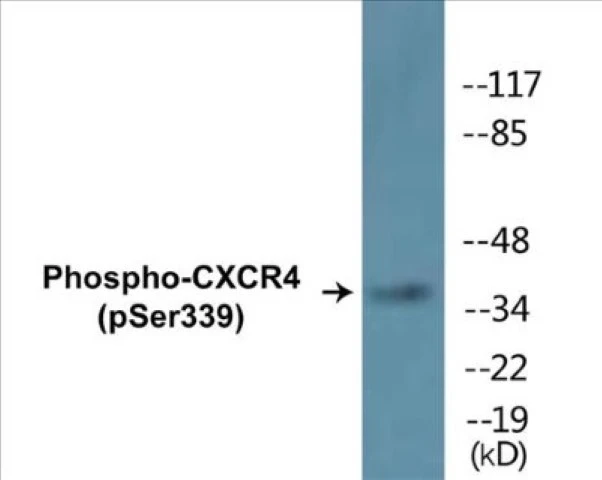 CXCR4 (phospho Ser339) Cell Based ELISA Kit (A102126-296)