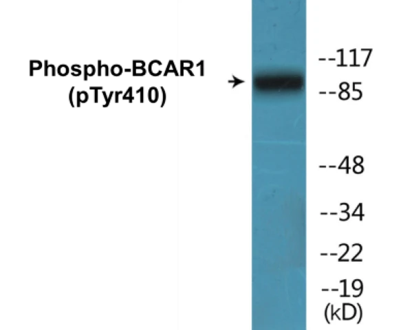 BCAR1 (phospho Tyr410) Cell Based ELISA Kit (A103783-296)