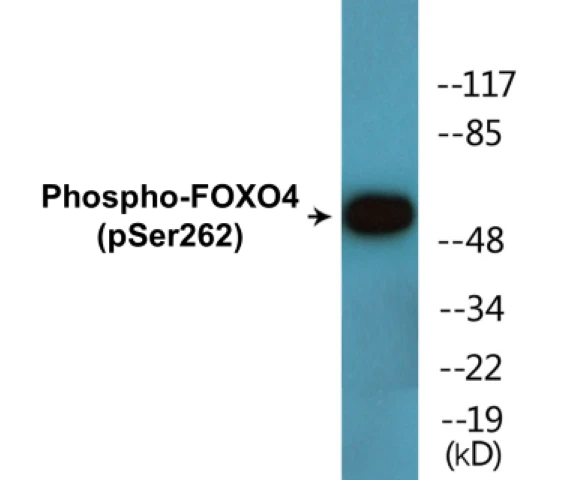 FOXO4 (phospho Ser262) Cell Based ELISA Kit (A102631-296)