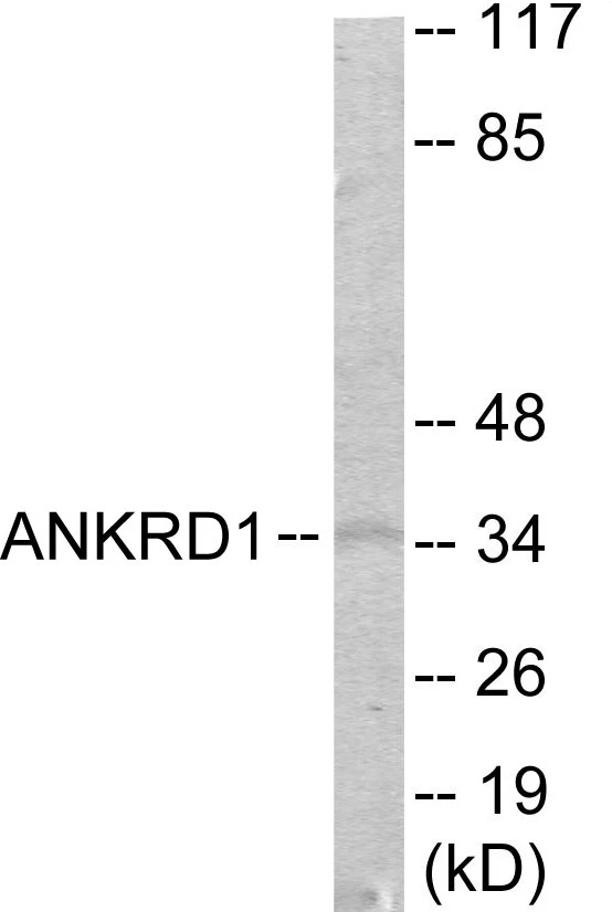 ANKRD1 Cell Based ELISA Kit (A103027-96)